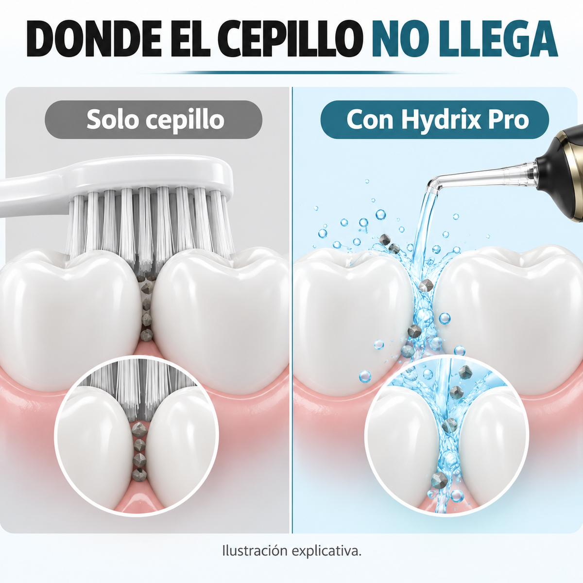 HYDRIX PRO - Irrigador Bucal Portátil - Limpieza y Salud 💧